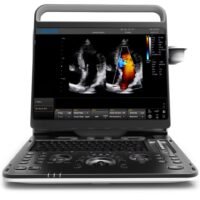 Chison EBit 60 Portable Ultrasound Machine