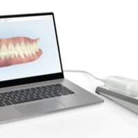iTero Element Flex Intraoral Scanner with Laptop